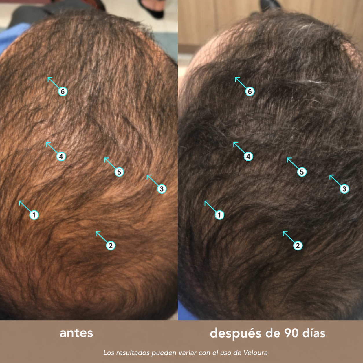 Veloura Sérum Molecular Anti-Caída Avanzado